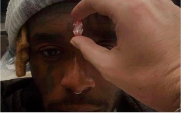 Lil Uzi Vert s’implante un diamant rose de 24 millions de dollars dans son front