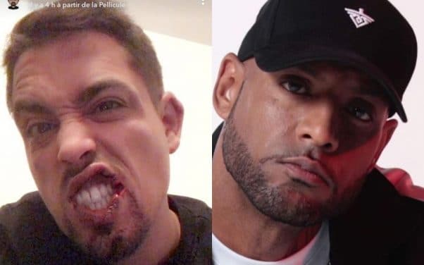 Lartiste parle de son agression sur Twitter, Booba se moque de lui sur Instagram