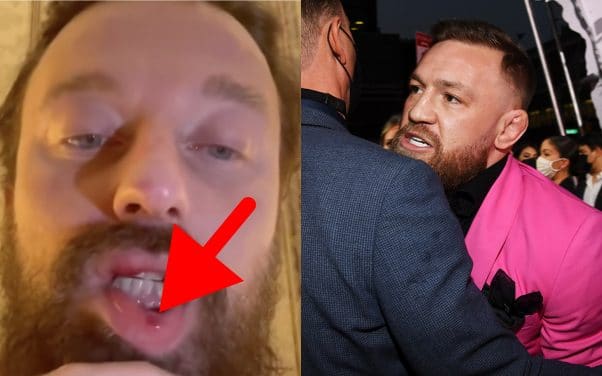 Conor McGregor va trop loin en cassant le nez d'un DJ italien en soirée