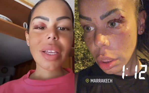 Tchikita agressée après avoir injurié des marocaines à Marrakech