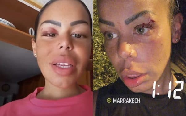 Tchikita agressée après avoir injurié des marocaines à Marrakech
