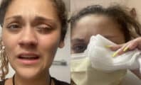 Une américaine confond de la superglue avec des gouttes et finit aux urgences