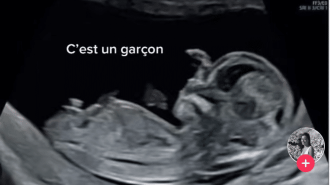 Ninho : une fan de seize ans donne son nom à son bébé