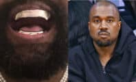 Mais que cache la mystérieuse dentition de Kanye West à 800 000 dollars ?