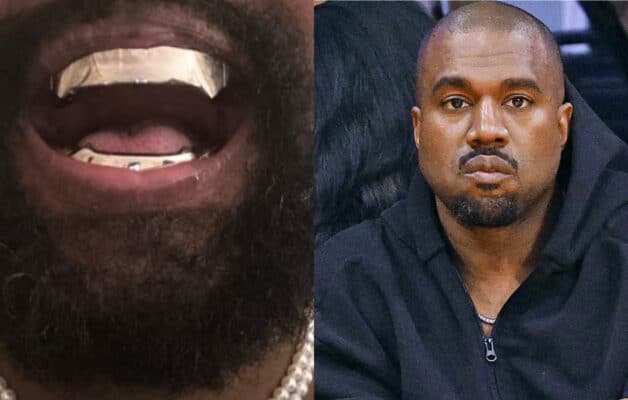 Mais que cache la mystérieuse dentition de Kanye West à 800 000 dollars ?