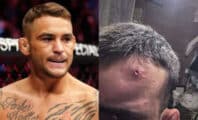 « Que des belles paroles » : Dustin Poirier doute des justifications de Benoit Saint-Denis