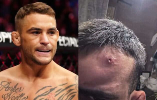 « Que des belles paroles » : Dustin Poirier doute des justifications de Benoit Saint-Denis