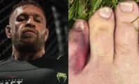 Forfait à cause de son orteil, Conor McGregor donne les conditions de son retour