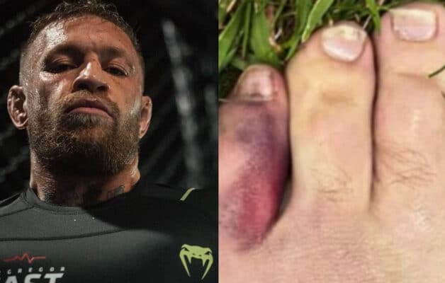 Forfait à cause de son orteil, Conor McGregor donne les conditions de son retour