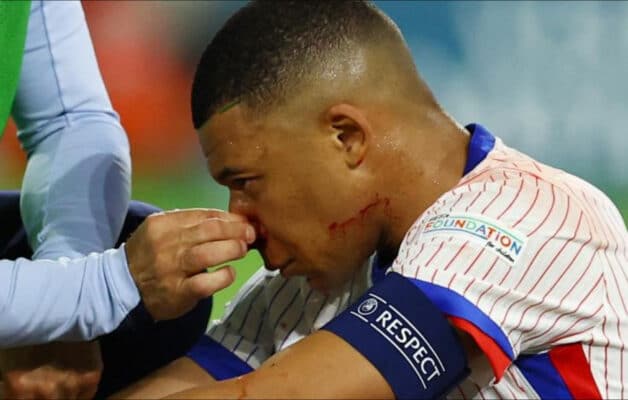 Euro 2024 : Kylian Mbappé prend la parole après sa fracture au nez