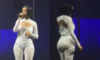 Shay a-t-elle cédé à l'appel du bistouri ? Son apparence sur scène sème le doute