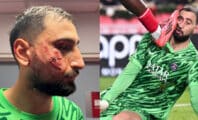 Gianluigi Donnarumma écrasé par un adversaire : son visage est méconnaissable