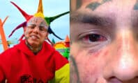 6ix9ine réclame un million de dollars en dommages et intérêts après son agression à la salle de sport