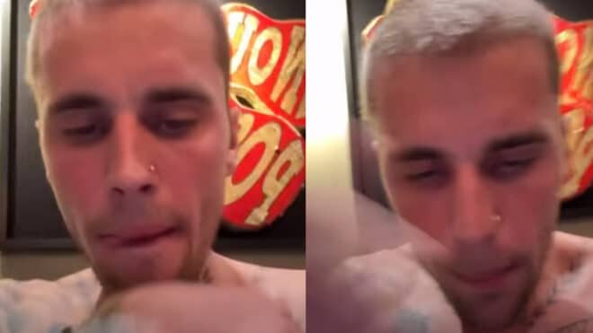 Justin Bieber dans un état second : la sombre vérité derrière ses lives